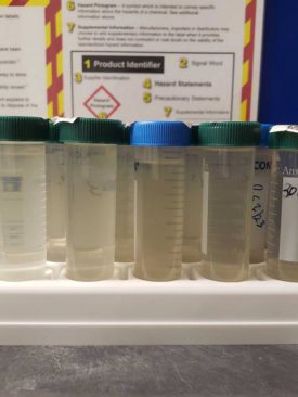 ประเมินการระบาดของไวรัสโควิด-19 จากน้ำเสียครัวเรือน