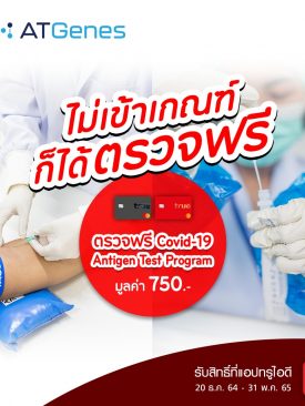 ซีซั่นนี้เราต้องรอด!!..ทรู มอบความห่วงใย ลูกค้าทรูแบล็ค ทรูเรด ตรวจ “Covid Antigen Test Program” ฟรี และลูกค้าทรูทั่วไป