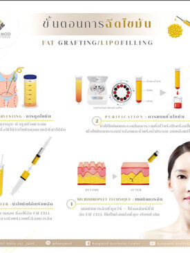 เติมเต็มรอยโรคร้ายด้วยศัลยกรรมความงาม ให้เป็นความสุขในชีวิต