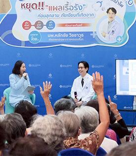 แพทย์ชี้เส้นเลือดขอด ภัยเงียบแต่ร้ายแรง! เสี่ยงแผลเรื้อรัง-เสียขา ไม่รู้ตัว