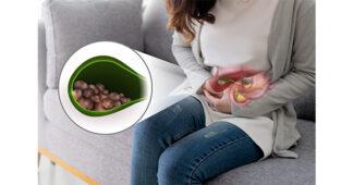 WMC สายปิ้งย่างต้องรู้ กินไม่ระวัง อาจเสี่ยงเป็น “นิ่วในถุงน้ำดี”