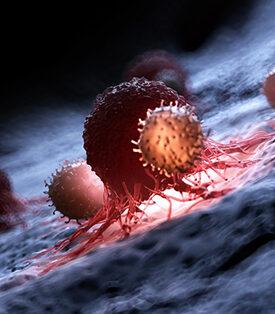 NK Cells Therapy เพชฌฆาตจัดการมะเร็ง